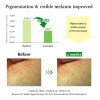 Sérum Suave De Vitamina C Dr.althea Para Un Tono De