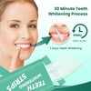 Teeth WHITENING Strips-Dentists FORMULATED-Residue Free-Non Sensitive-Enamel Safe-Mint FLAVOUR-14 Treatments 28