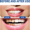 Sp 10 Toothpaste, Sp 10 Probiotic Toothpaste(1Pcs)