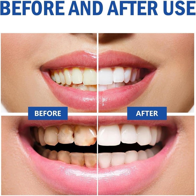 Sp 10 Toothpaste, Sp 10 Probiotic Toothpaste(1Pcs)