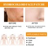 Face Acne Patches Hydrating and Purifying Forehead Nose Chin Cheek