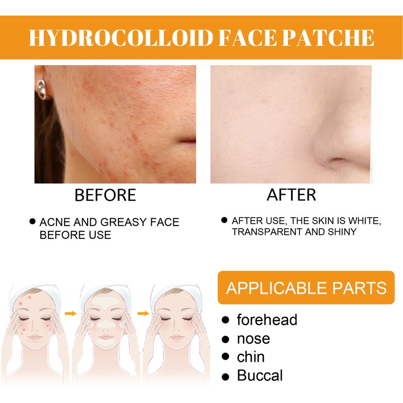 Face Acne Patches Hydrating and Purifying Forehead Nose Chin Cheek
