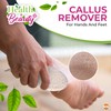 8pk Natural Pumice Stone for Feet | Callus Remover Feet