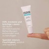 ISDIN Acniben Repair Lip Balm 10 ml