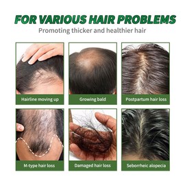 Batana Oil, Batana Oil For Hair Growth, 30ML- Frizz Repair Solution, Improves Dryness, Smoothes And Shines, Reduces Hair Loss, Moisturizes, And Promotes Thick Hair-for Men And Women