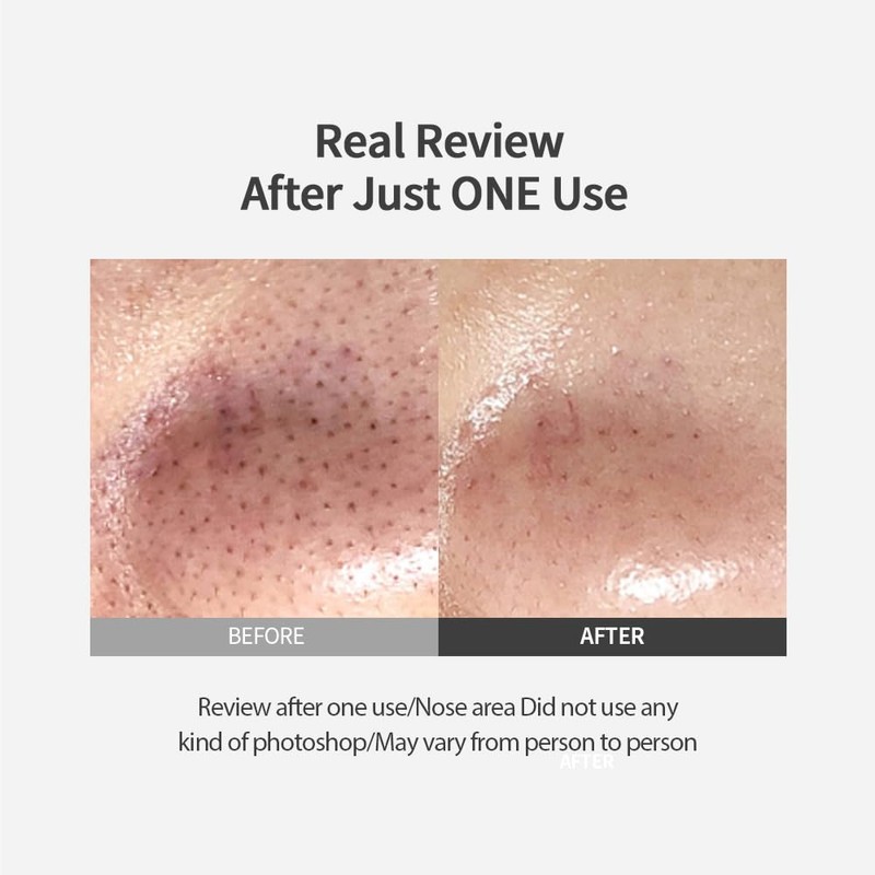 SUNGBOON EDITOR SUNGBOON EDITOR Blackhead Melting Clear Pad 65g(30pcs)