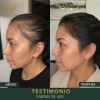 1 Shampoo Anticaída Y Crecimiento Chile Y Romero Vital Root