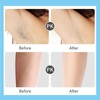 Electric Hair Removal Epilator Rechargeable Detachable Head for Women Man