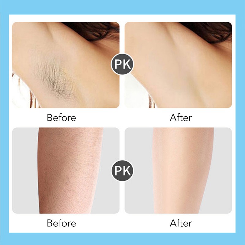 Electric Hair Removal Epilator Rechargeable Detachable Head for Women Man