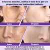 Crema Epiglow Melanex Advanced Anti-Hiperpigmentación