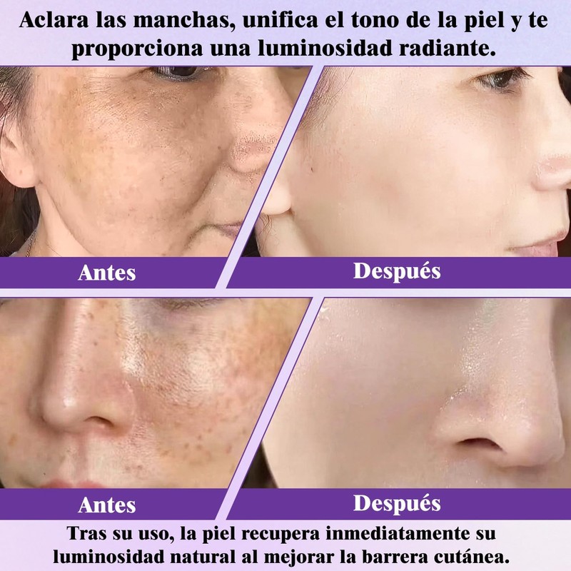 Crema Epiglow Melanex Advanced Anti-Hiperpigmentación