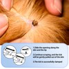 LUMOOM Tick Remover with Magnifying Glass, Quick Cleaning of Tick
