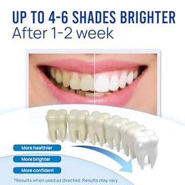 VieBeauti Teeth Whitening Pen (4 Pcs), 40+ Uses, Effective, Painless, No Sensitivity, Travel-Friendly, Easy to Use, Beautiful White Smile, Mint Flavor