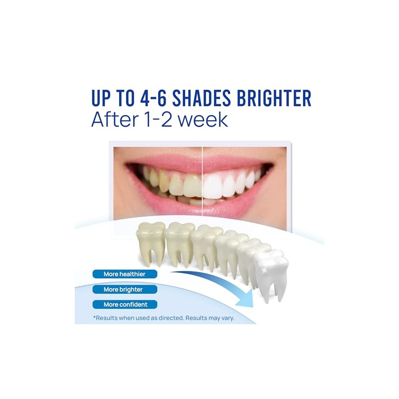 VieBeauti Teeth Whitening Pen (4 Pcs), 40+ Uses, Effective, Painless,