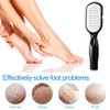Foot File Callus Remover