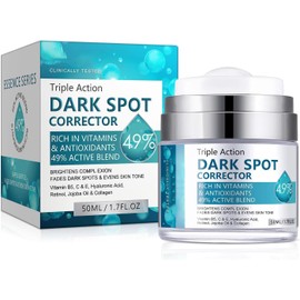 Dark Spot Remover for Face & Body, Dark Spot Remover, Dark Spot Corrector, Freckle Removel Cream, Reduces Hyperpigmentation, Age Spots, Sun Spot, Improve Skin Tone, for All Skin Types