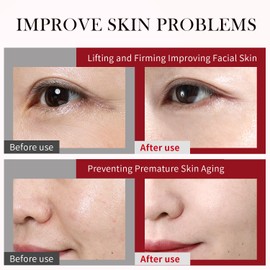 HEALOINE Serum Mask Rice Nature Facial Mask Real Collagen Hydrating Firming Elasticity Overnight Trend Items Korean Skin Care 30g*10Sheet