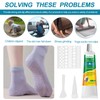 Smdrafy Sock Stop, Liquid Sock Stop, Stopper for Socks, Sock
