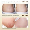 Pregnancy Stretch Mark Cream | OB-GYN Recommended Formula for Reducing