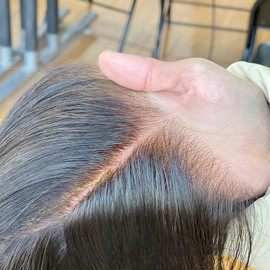 SKINLIKE Real HD Swiss Lace Closure Human Hair 5x5 Lace Closure with Clean Hairline Much More Density Full Cuticle Aligned Brazilian Human Hair Body Wave Style (20inch, HD BW 5x5 lace clsoure)