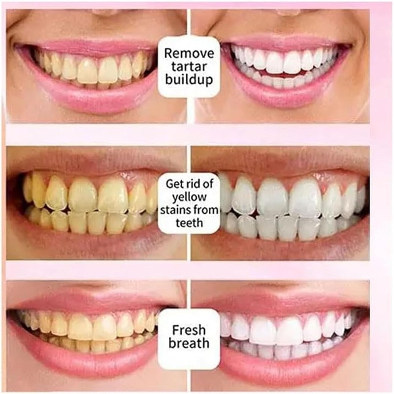 Sp-6 Zahnpasta,Probiotics Bright White Zahnpasta, Ultra Whitening Toothpaste Sp-6, Toothpaste