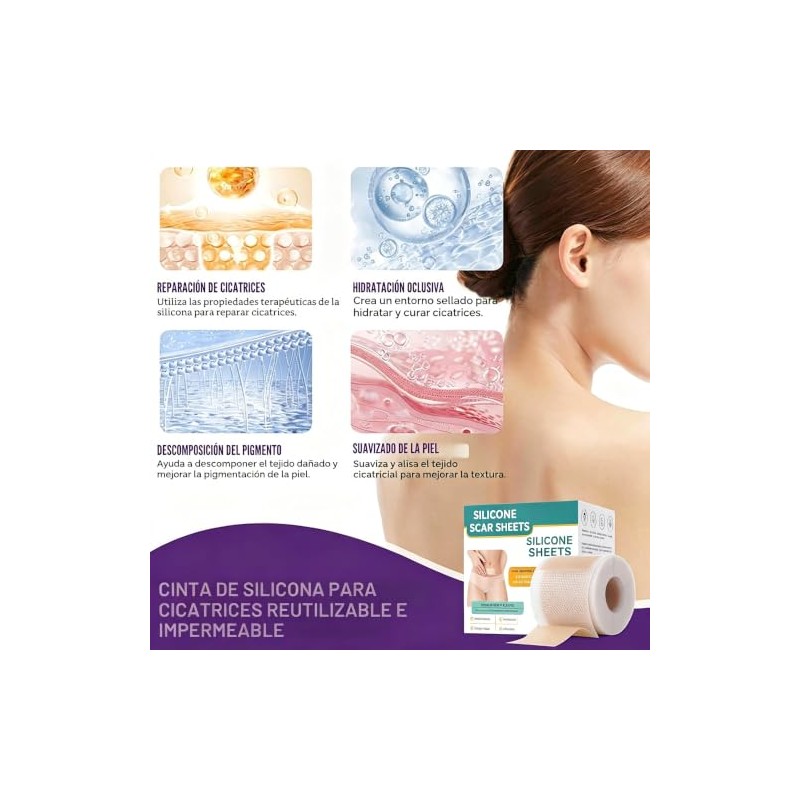 MXBEAUTY Parches de Silicona para Cicatrices