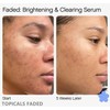 TOPICALS FADED Serum Vegan, Gluten-Free and Cruelty-Free- 1.7OZ/50ML(NEW VERSION)