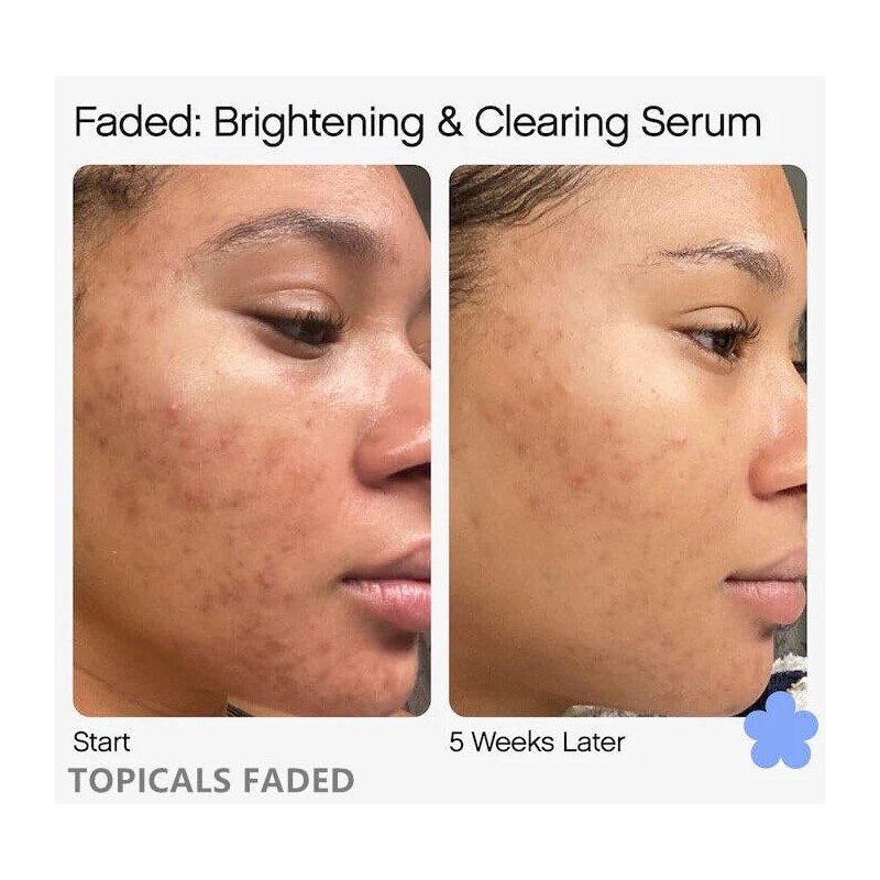 TOPICALS FADED Serum Vegan, Gluten-Free and Cruelty-Free- 1.7OZ/50ML(NEW VERSION)