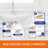Palmer’s Skin Success Extra Strength Suero Corrector de Tono, Ayuda