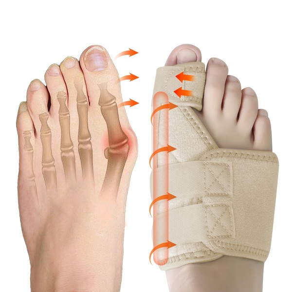 Ruilabao Hallux Valgus Correction Splint for Left and Right Hallux