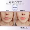 Wondery Dispositivo Rejuvenecedor Facial con Microcorriente + Gel Conductor 60
