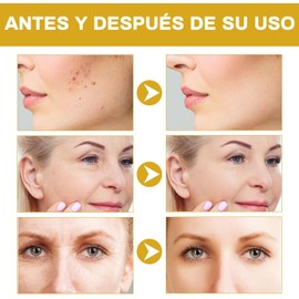 2pcs Advanced snail mucin power essence 100 Ml，Snail Mucin Essence，Esencia hidratante facial, potentemente hidratante, de fácil absorción, indicada para pieles apagadas y con líneas de expresión，pares