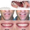 2PCS False Teeth - Unisex Snap-On Veneer - False Tooth
