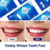 Teeth Whitening Strip 14 Treatments Kit: 28Pcs Enamel Safe Whitening