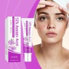 Ouhoecrema Facial Cuidado Acné Ácido Azelaic