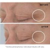 Strivectin Nia114 Acids Hyaluronic Tripeptide Gel Crema Ojos