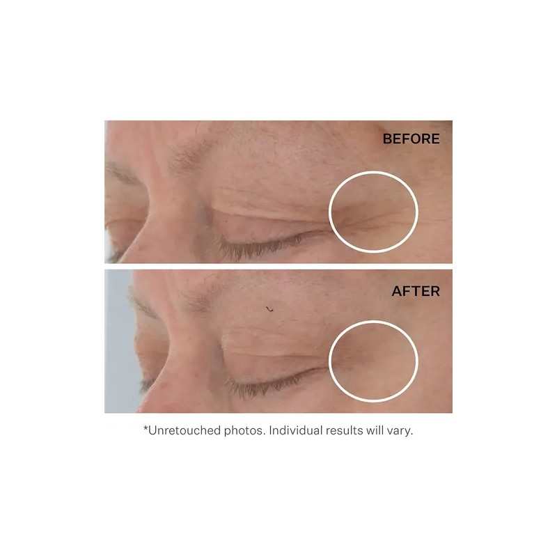 Strivectin Nia114 Acids Hyaluronic Tripeptide Gel Crema Ojos