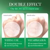3% Salicylic Acid Face Pads - Exfoliating Face pads for