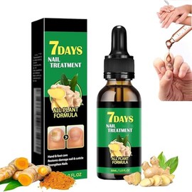 Ginger Nail, Tratamiento de Uñas con Jengibre, Soporte para Uñas | Cuidado de Uñas, Suero para El Crecimiento de Uñas con Jengibre, Aceite Fortalecedo