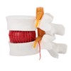 Human Lumbar Disc Herniation Model, 1.5 Times Durable and Lightweight