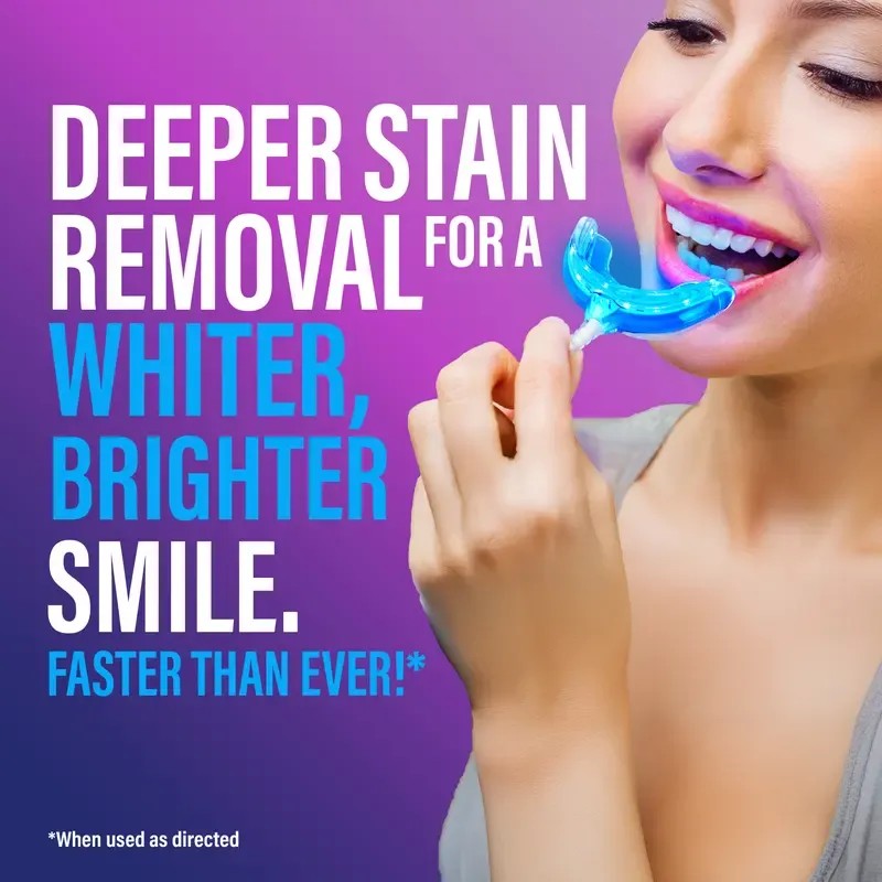 Premium Wired Teeth Whitening Kit – LED Light Teeth Whitening