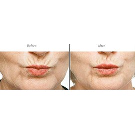 Bellahut Upper Lip/Perioral Smoothing Peptide (120ml / 4 OZ)