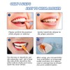 Aligner Tray, 12-Pack Medical Grade Silicone Orthodontic Chompers Aligner Trays