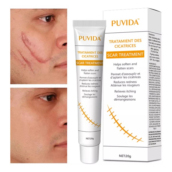 Crema Cicatricial De Minimizar Y Reducir Las Cicatrices 20g