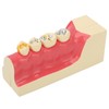 Right Lower Posterior Tooth Model 2X Magnification Detachable Resin Tooth