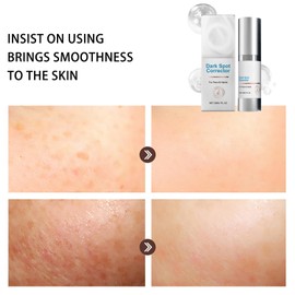 Feline Dark Spot Corrector,Feline Skinscience Dark Spot Corrector,Fel/ine D/ark S/pot Corr/ector Serum,Da/rk S/pot Remover,Da/rkSp/ot Cor/rector Cream,Anti Aging Seru/m for Face,Brightening Ser/um