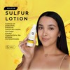 Pili Sulfur Lotion – Helps Control Oily Skin & Reduce
