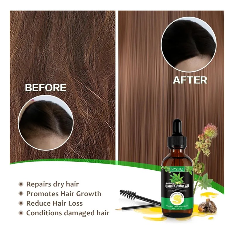 Aceite De Ricino Negro (2 Unidades) Para El Cabello//*