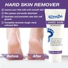 ClearZal Foot Cream For Hard Skin, Helps Calluses and Corn