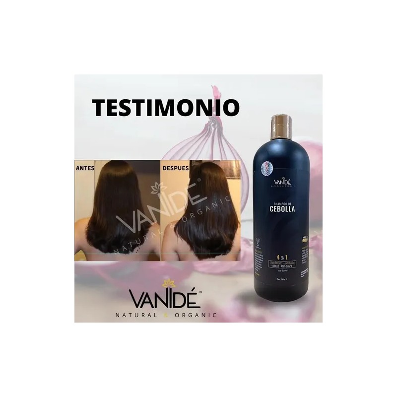 Shampoo de Cebolla Anticaída 2 Pack Onion Anti-Hair Loss Shampoo,